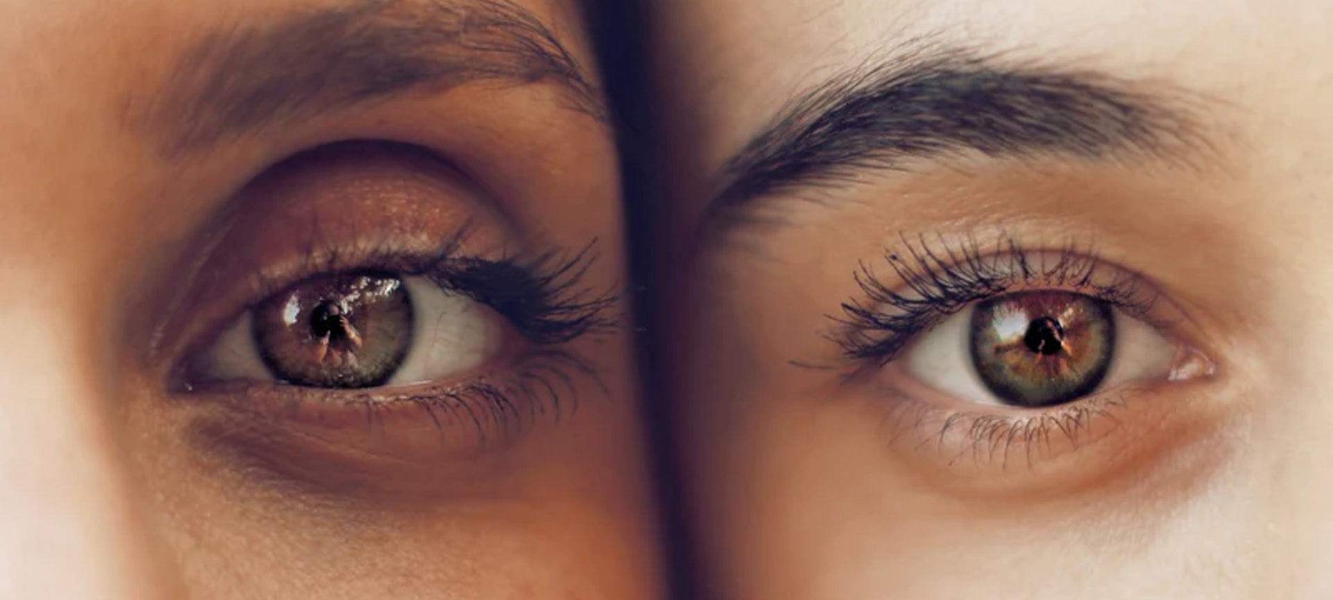 Under Eye Care Can Take Years Off Your Face - Secret Skin